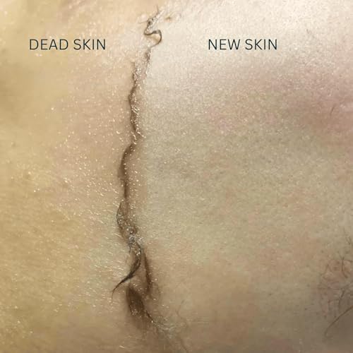 Dermaplaning Oil for Dry Skin - Hydrating Face Shaving Oil for Women - Safe for Acne Prone Skin - Non Comedogenic, Fragrance Free, Natural and Hypoallergenic for Pre & Post Dermaplaning 4oz by Ouiloe