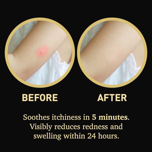 Bioactive Skin Rescue Hypochlorous Acid HOCl Gel Serum, 2oz
