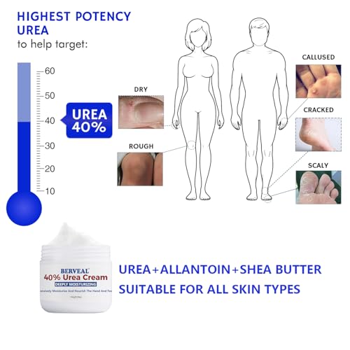 Urea Foot Cream 40% for Cracked Heels – Intensive Moisturizing Lotion 5.29 fl oz