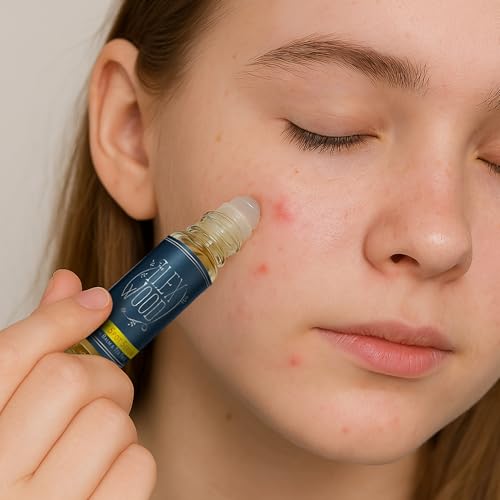The Ilex Wood Spot Soothing Serum - Tea Tree & Lemon Balm Blemish Treatment, 0.34 Fl Oz