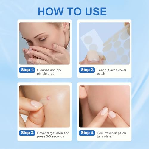 Amouy Acne Pimple Patch- 2 Sizes 612 Dots Thin & Thick Hydrocolloid
