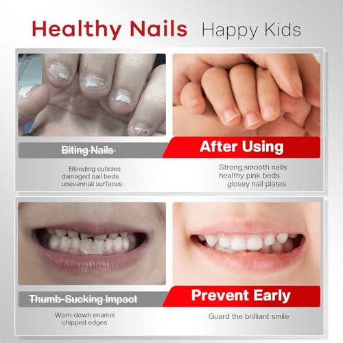 Glamonade 2-in-1 Nail Biting Treatment Kit with Bitter Polish & File