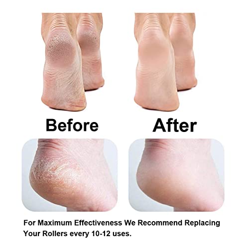 12 Pack Replacement Extra Coarse Rollers for Dr. Scholl's Callus Remover Foot File