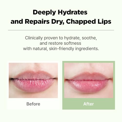 CICA GO Cica Lip Balm - Daily Hydrating Treatment for Dry Lips