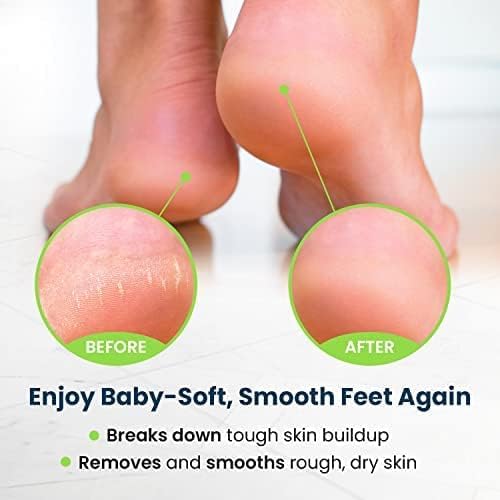Exfoliating Foot Care Set - Callus Remover & Pedicure Kit with Tea Tree Oil Soak, Urea Cream | 4-Piece Made in USA