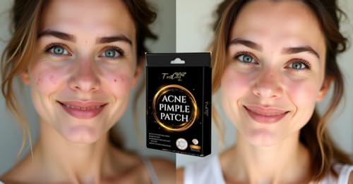 TrustLuxe Glow Hydrocolloid Acne Pimple Patches – Waterproof & Invisible, 36 Count