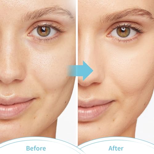 CONBELLA Reusable Gel Face Mask for Hot & Cold Therapy, 2 Pack