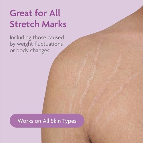 TriLASTIN Stretch Mark Cream ? Collagen & Elastin Support Body Cream with Niacinamide, Vitamin C & Vitamin E ? Hydrating Stretch Mark Lotion for Belly, Hips & Thighs ? Unscented - 5.5 oz