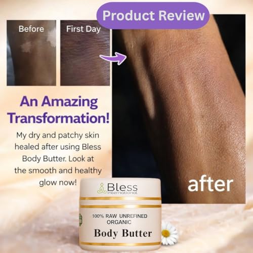 100% Pure Organic Raw Cocoa Butter - Grade A Moisturizer 8oz