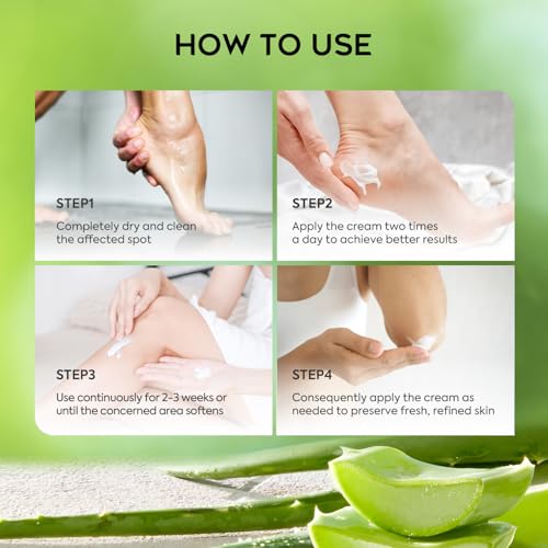 Vebuni Urea 42% Foot Cream with Salicylic Acid for Callus Removal & Moisturizing