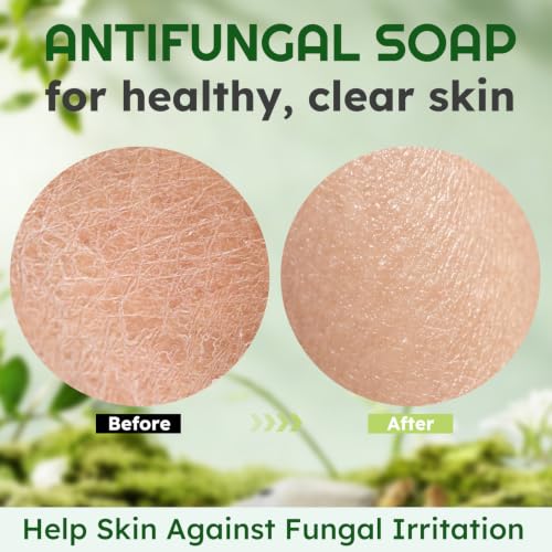 Antifungal & Antibacterial Tea Tree Oil Soap Bar - 2 Pack for Skin Care