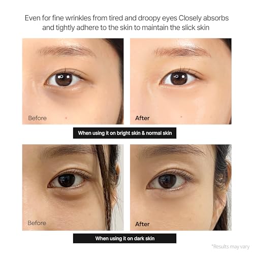 Dr.Melaxin Calcium Dark Spot Eye Cream 15g ? Niacinamide & Calcium Gluconate Eye Cream for Dark Circles, Under Eye Bags & Sagging | Hydrolyzed Elastin EX Volume Firming | Korean Eye Cream
