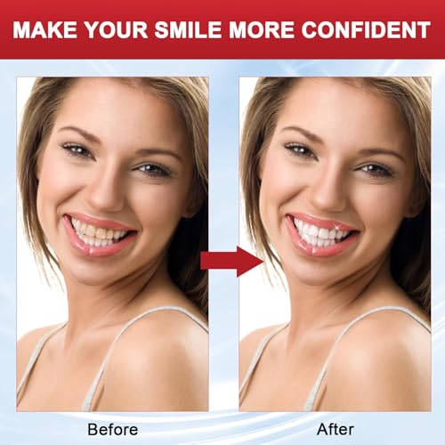 SP-8 Whitening Toothpaste - Mint Fresh Breath Daily Cleaning Paste (2 Pack)
