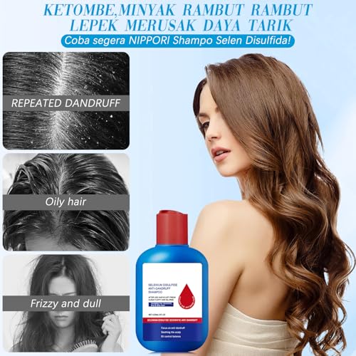 Viuvoiul Nipori Dandruff Shampoo for Men & Women - Oil Control & Scalp Care 120ML