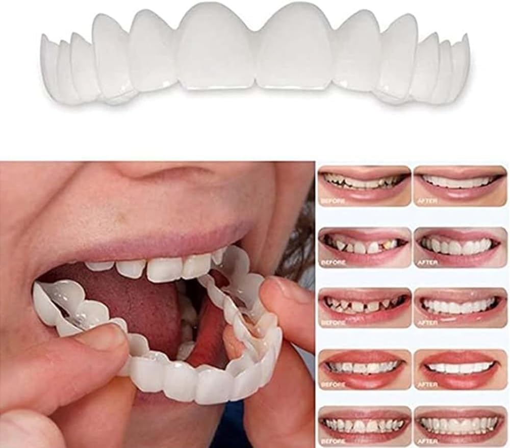 2 Pairs, Beautiful Smile,Top and Bottom, Temporarily Adjustable for Men and Women Teeth Whitening Kits(white01)