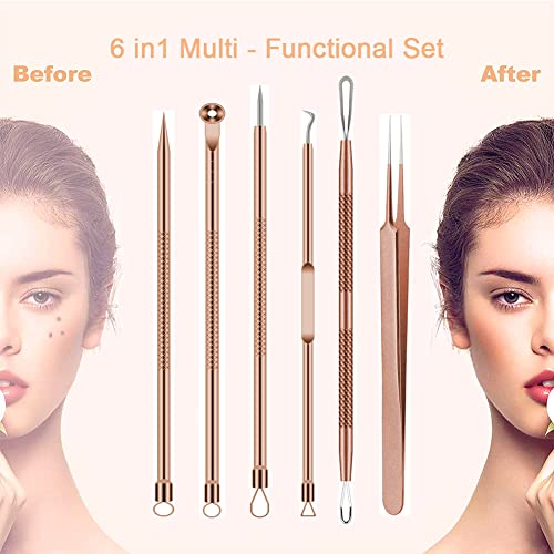 BLAAROOM Rose Gold 6-Piece Pimple Extractor Kit - Blackhead & Acne Removal Tools