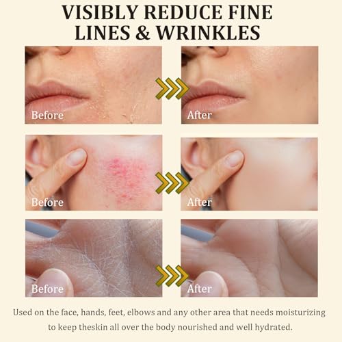 Beef Tallow Face Moisturizer with Raw Honey & Vitamin E
