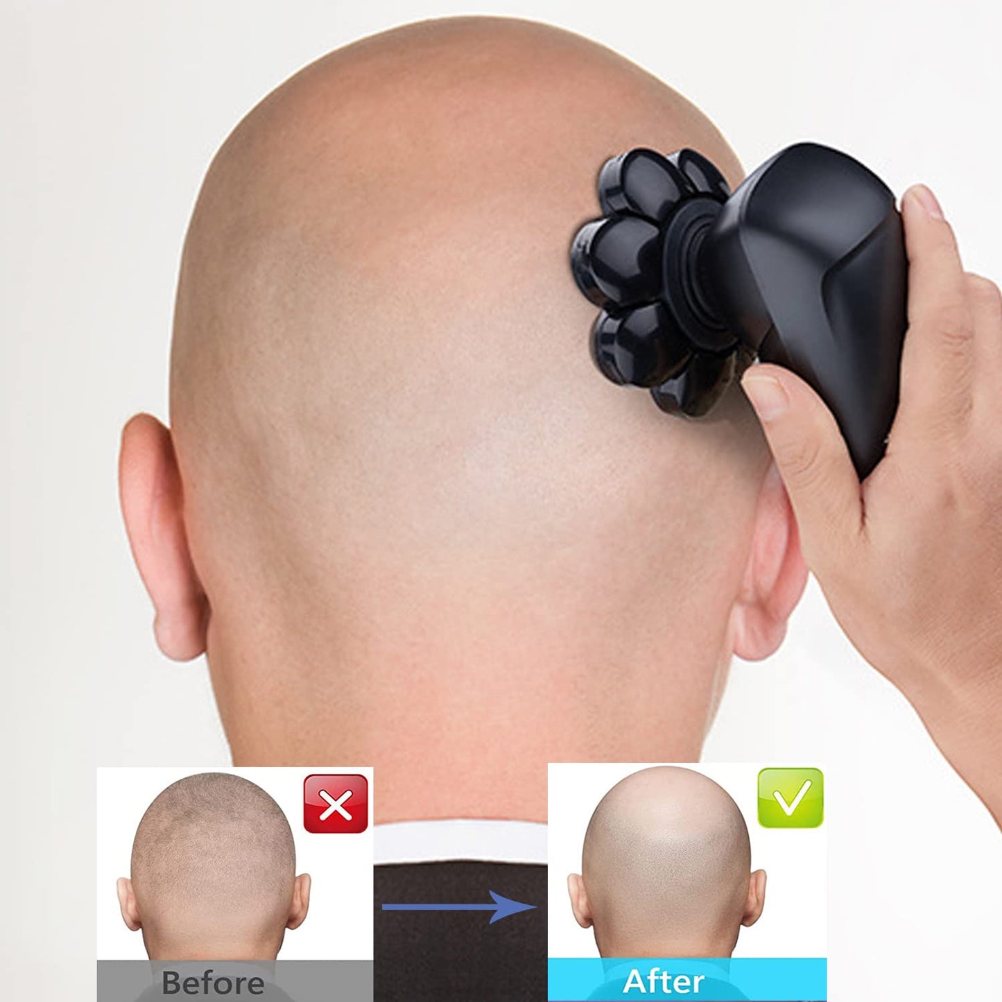 5 Blades Men's Electric Shaver Replacement Heads Razor Shaver Replacement Blades Bald head shaver replacement blades for Bald and Face (Black)