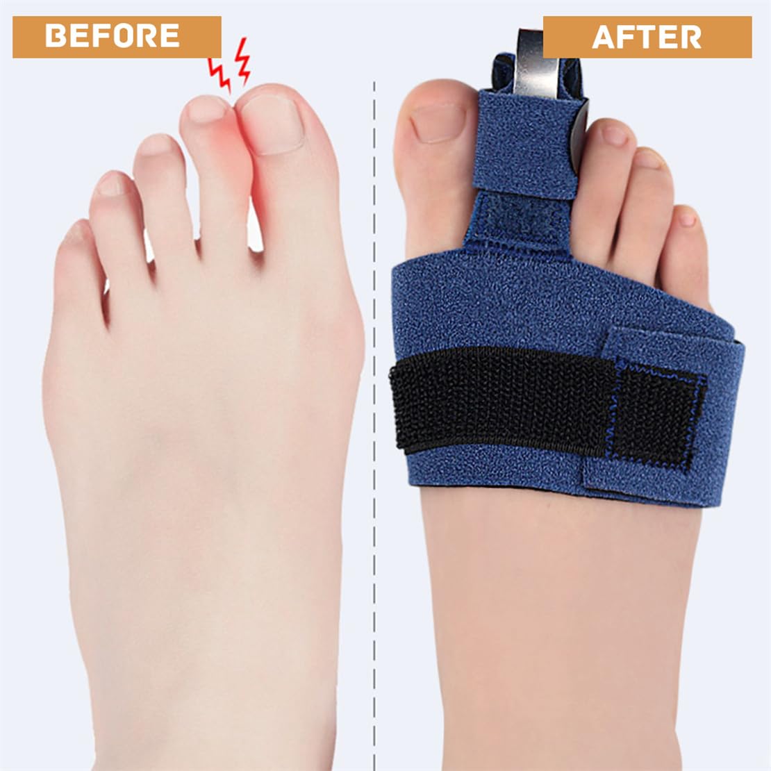 YJWZWE Toe Splints for Straightening Hammertoes Toe Brace Toe Straightener Toe Straps for Women Men Broken Toe Curled Toes Pain and Support 2Pcs
