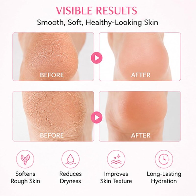 Sakura Foot Heel Stick - Cracked Heel Repair Balm with Shea Butter | 2-Pack, Moisturizing Formula for Hands, Heels, Elbows, Knees