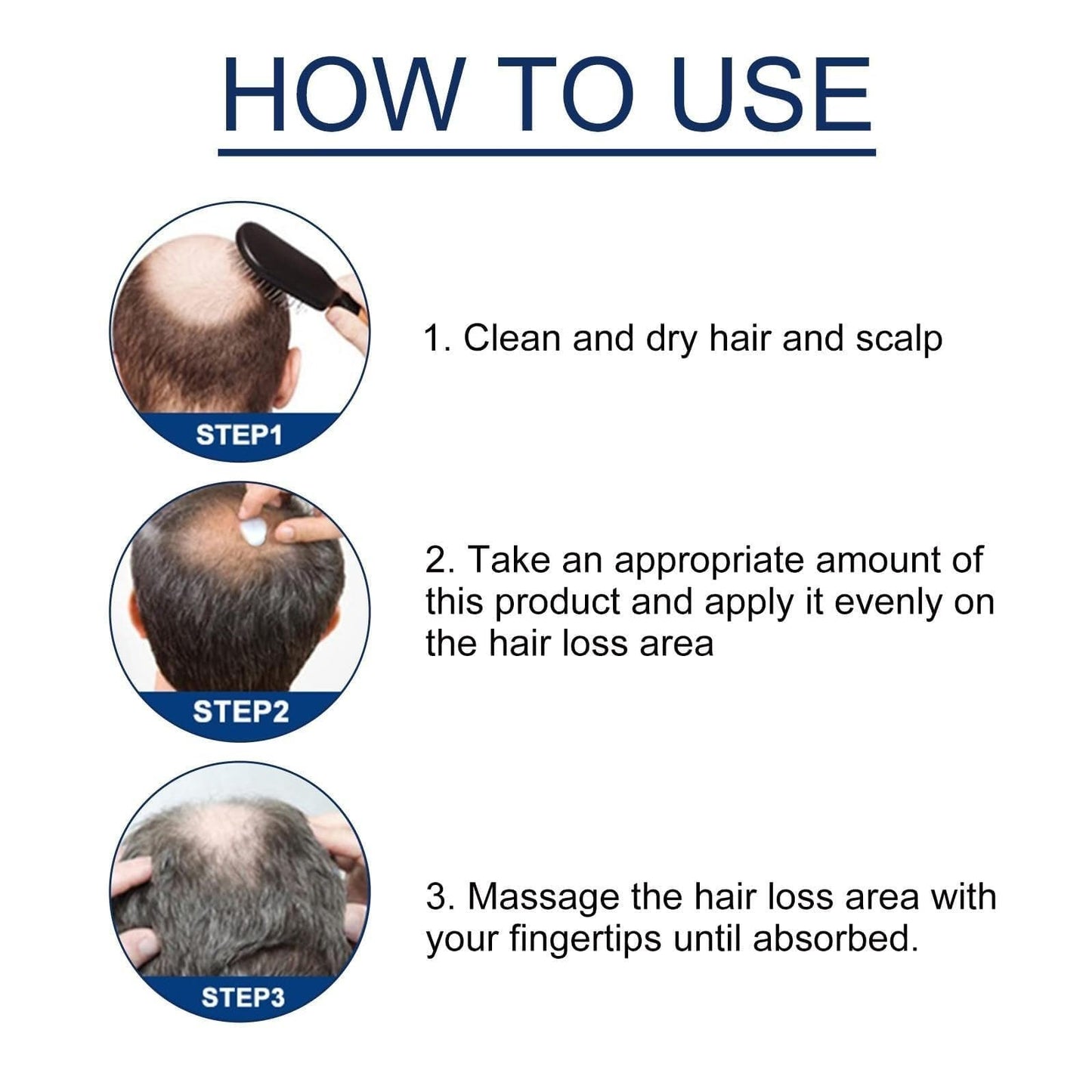 Alopecia Hair Products Suitable for Men & Women