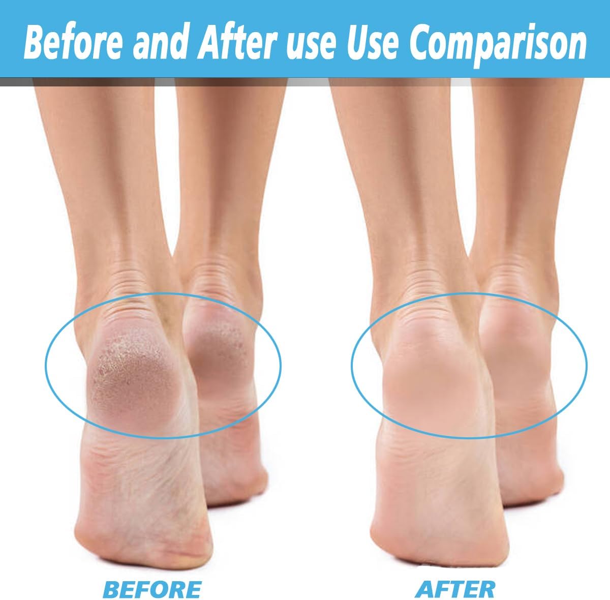 Replacement Roller Heads for Flawless Pedi - 12 Pack Refills | 6 Extra Coarse & 6 Regular Coarse