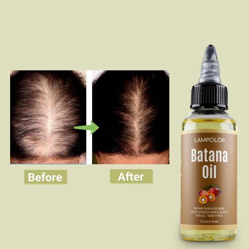 Batana Oil for Hair Growth - 100% Pure & Natural Unrefined Oil | Thicker, Stronger Hair - 2 FL OZ (60ml)