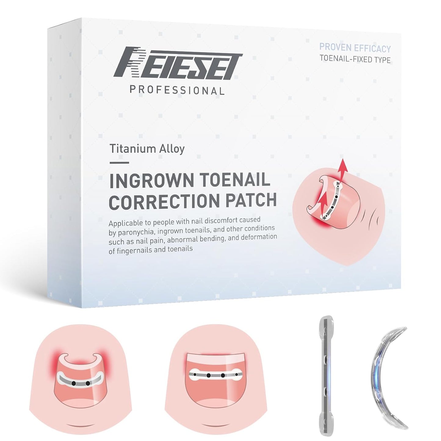 Ingrown Toenail Treatment Kit - Titanium Alloy Nail Tools for Curved Nail Repair | 0.59/0.67in