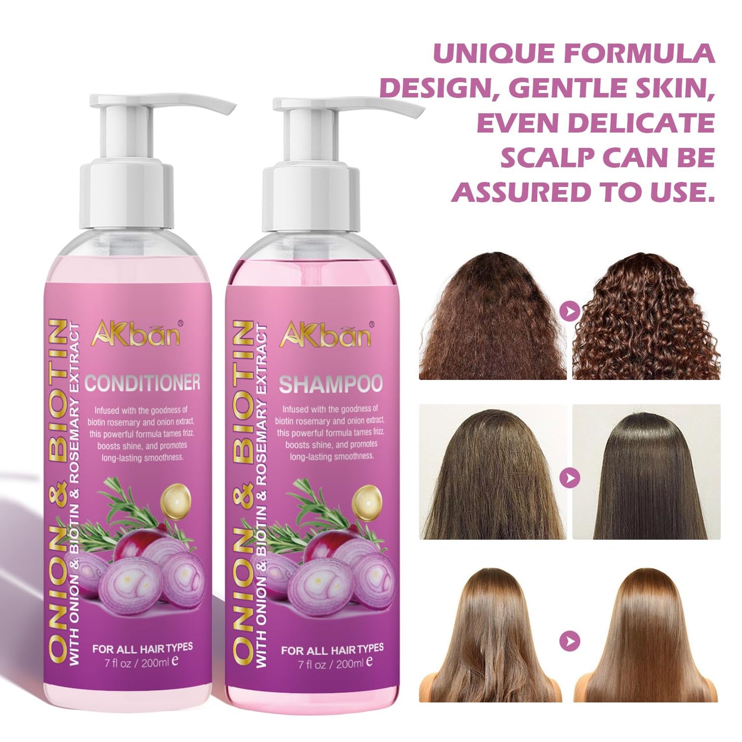 Onion Rosemary and Biotin Shampoo and Conditioner Set for Strengthening, Moisturizing & Encouraging Longer, Healthier Hair, Hair Loss and Thinning Hair, Paraben-Free, Growth Shampoo and Treatment Set