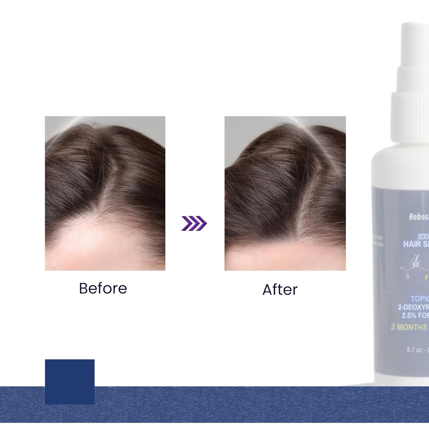 Deoxyribose Sugar Hair Gel - 2.5% Lab-Grade Formula for Hair Growth | 5.7 oz / 150ml