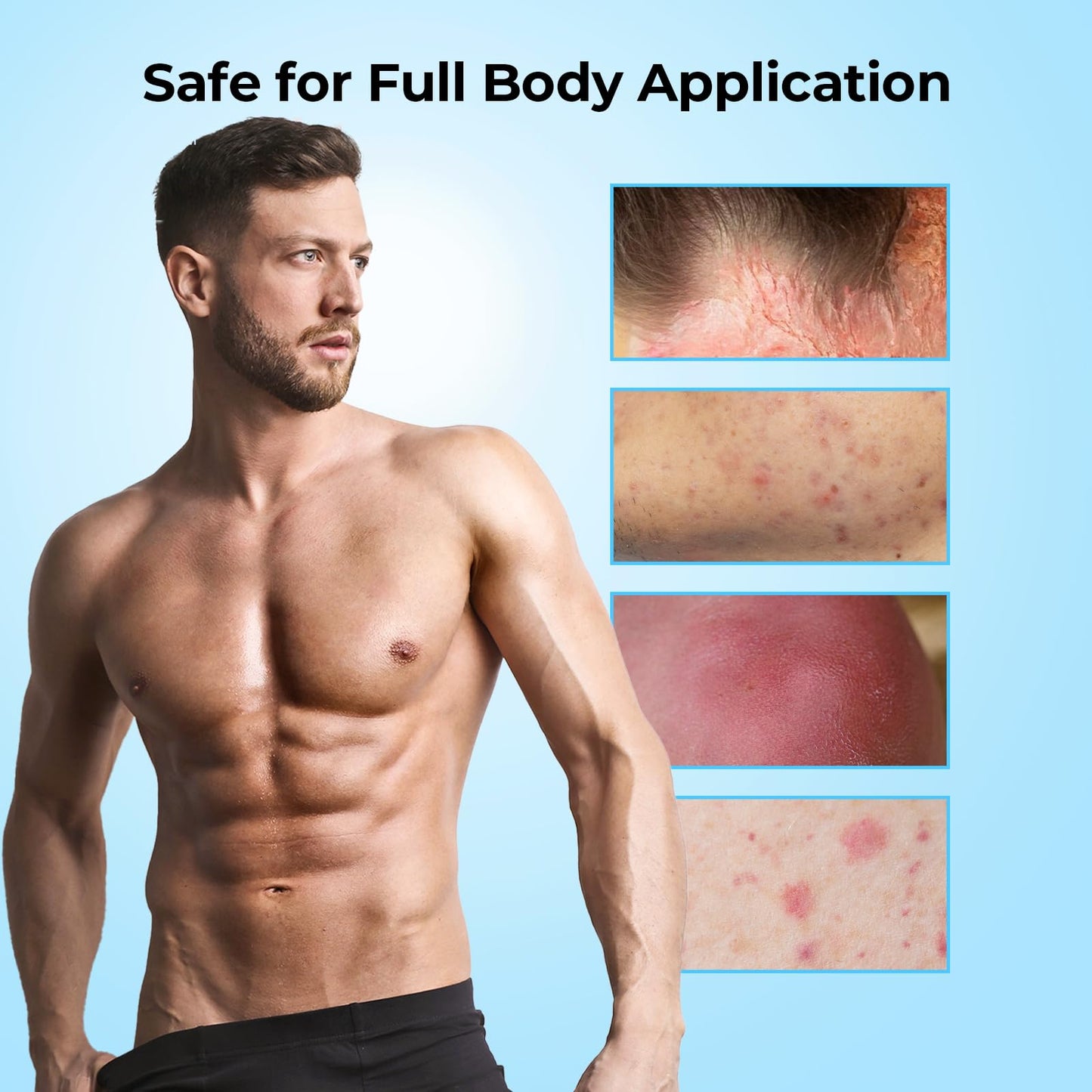 SilkyShark Folliculitis Treatment Cream (4.23 oz), Soothing Relief for Razor Bumps, Acne, Ingrown Hairs & Skin Irritation, Fast Absorbing, Non-Greasy Formula with Natural Ingredients for Body & Scalp