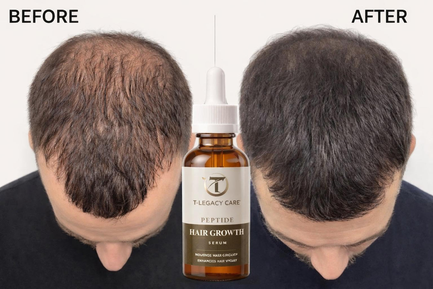 Hair Growth Serum for Women & Men, Hydrating Scalp Treatment for Thicker Stronger Looking Hair, 30ml