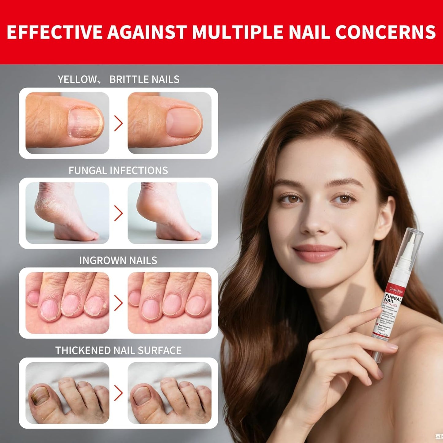 Toenail Fungus Treatment Pen - Extra Strength Nail Repair with Tea Tree Oil | 3-Pack for Discolored, Thick Nails