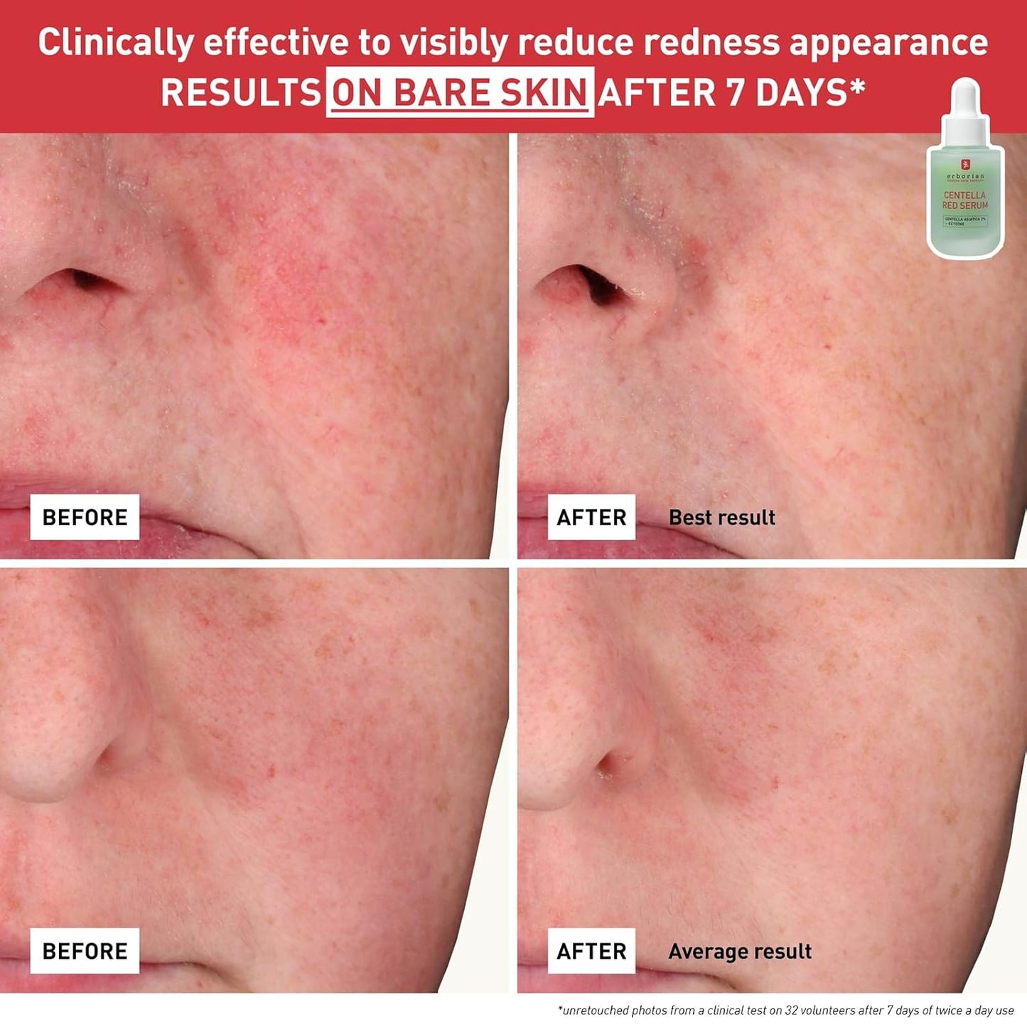 Erborian Red Serum - Daily Hydrating Redness Treatment for Sensitive Skin | Lightweight Barrier Support with Centella