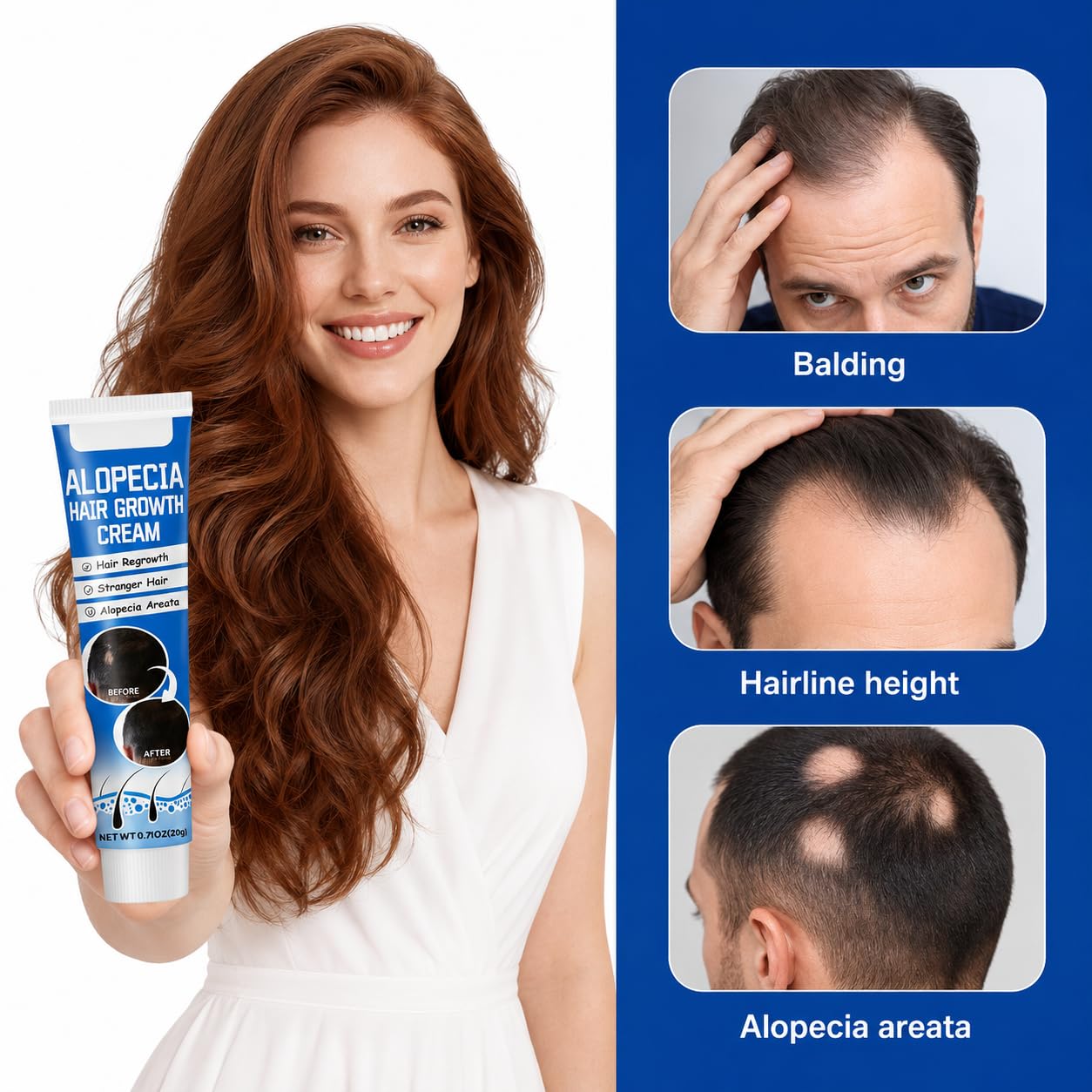 Alopecia Hair Growth Cream with Biotin & Rosemary Oil | Anti Hair Loss Treatment for Thicker Fuller Hair, Scalp Nourishing Butter for Thinning Hair, Intensive Hair Densifying Essence for Men & Women