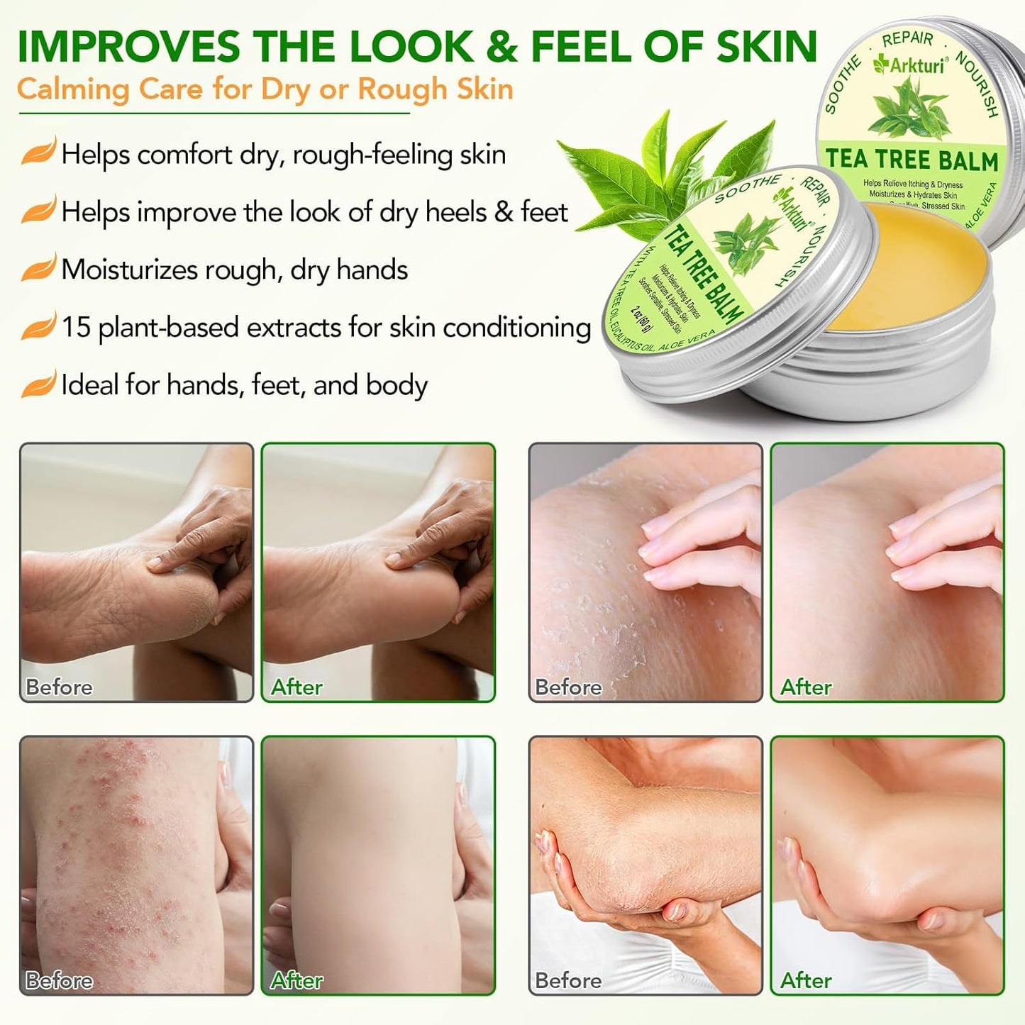 Tea Tree Oil Balm for Dry Skin Relief | Organic & Safe for All Ages - 1 Pack