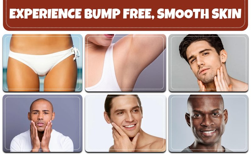 BUMP Terminator EXTRA STRENGTH, Fast Acting, Alcohol BASED, Water Free Anti Razor Bumps, Ingrown Hair, Skin Treatment for Face, Neck, Bikini Area, Legs & Back Of Head Bumps Remover, Unisex Roll On
