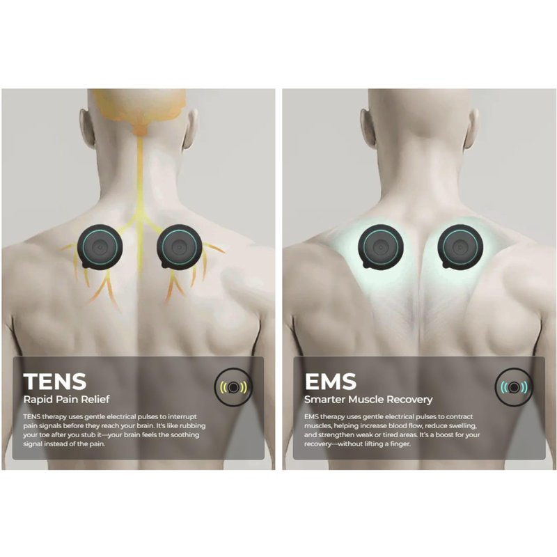 Chirp Halo Wireless Muscle Stimulator – Portable EMS Device for Muscle Recovery, Pain Relief, and Strength Training, Stimulate Muscles for Faster Recovery & Growth (Double)