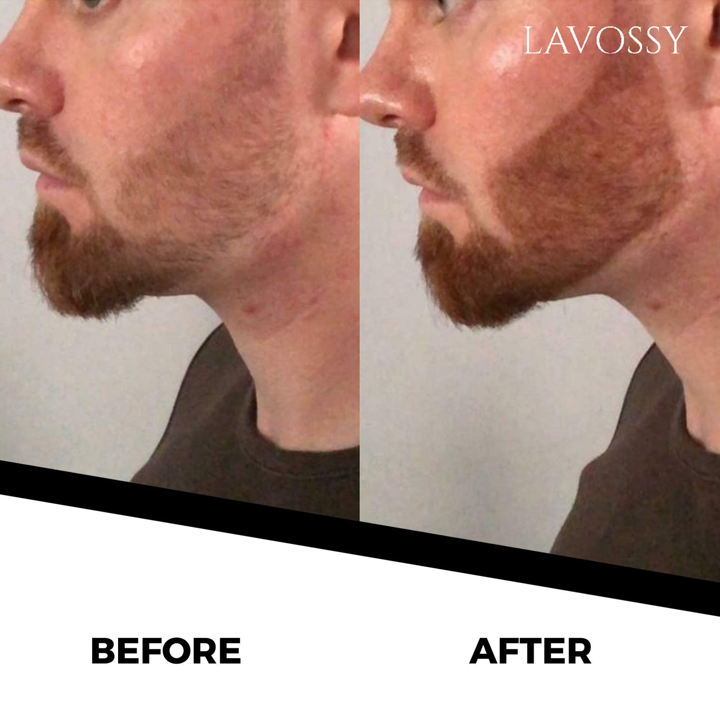 LAVOSSY Beard Pencil Filler for Men - Long Lasting and Easy to Use Beard Pen with blending brush results in a sleek & natural look, Water/Sweat Proof filler (Dark Brown, Value Pack (Pack of 3))
