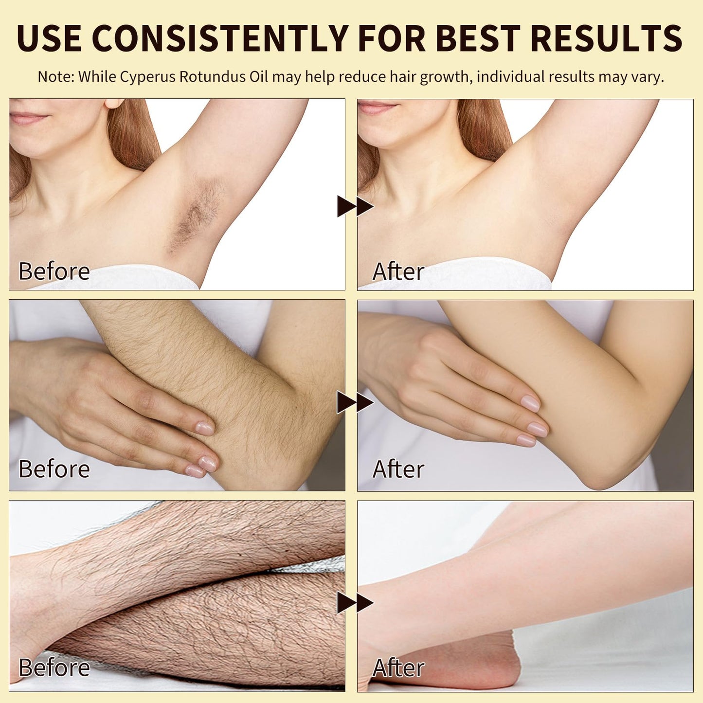 Cyperus Rotundus Oil for Hair Removal, 2PCS 100% Pure Natural Body and Facial Hair Removal for Women, Reduces Unwanted Hair Growth After Shave, Shrink Pores, Hydrates, Soothes and Repairs Skin
