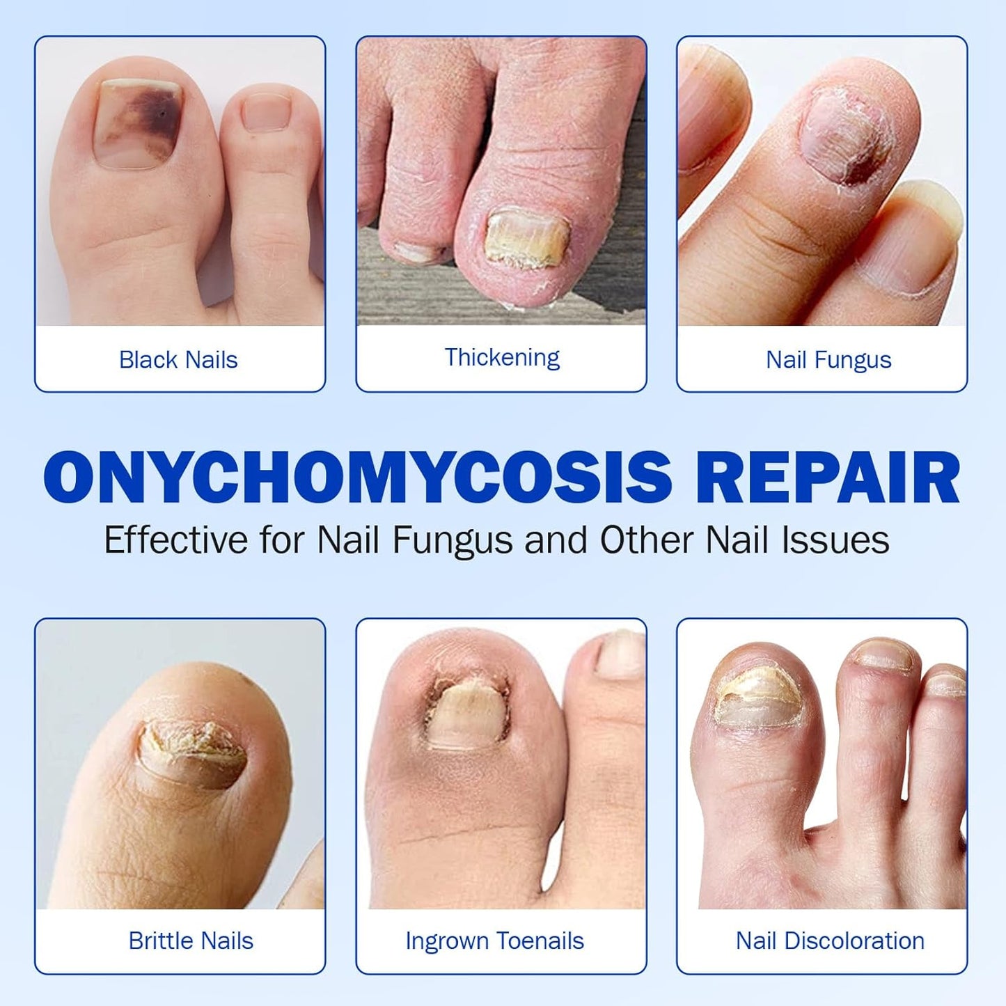 Toenail Treatment Patches - Extra Strength Hydrogel Repair for Damaged, Thick & Brittle Toenails | 42PCS Set