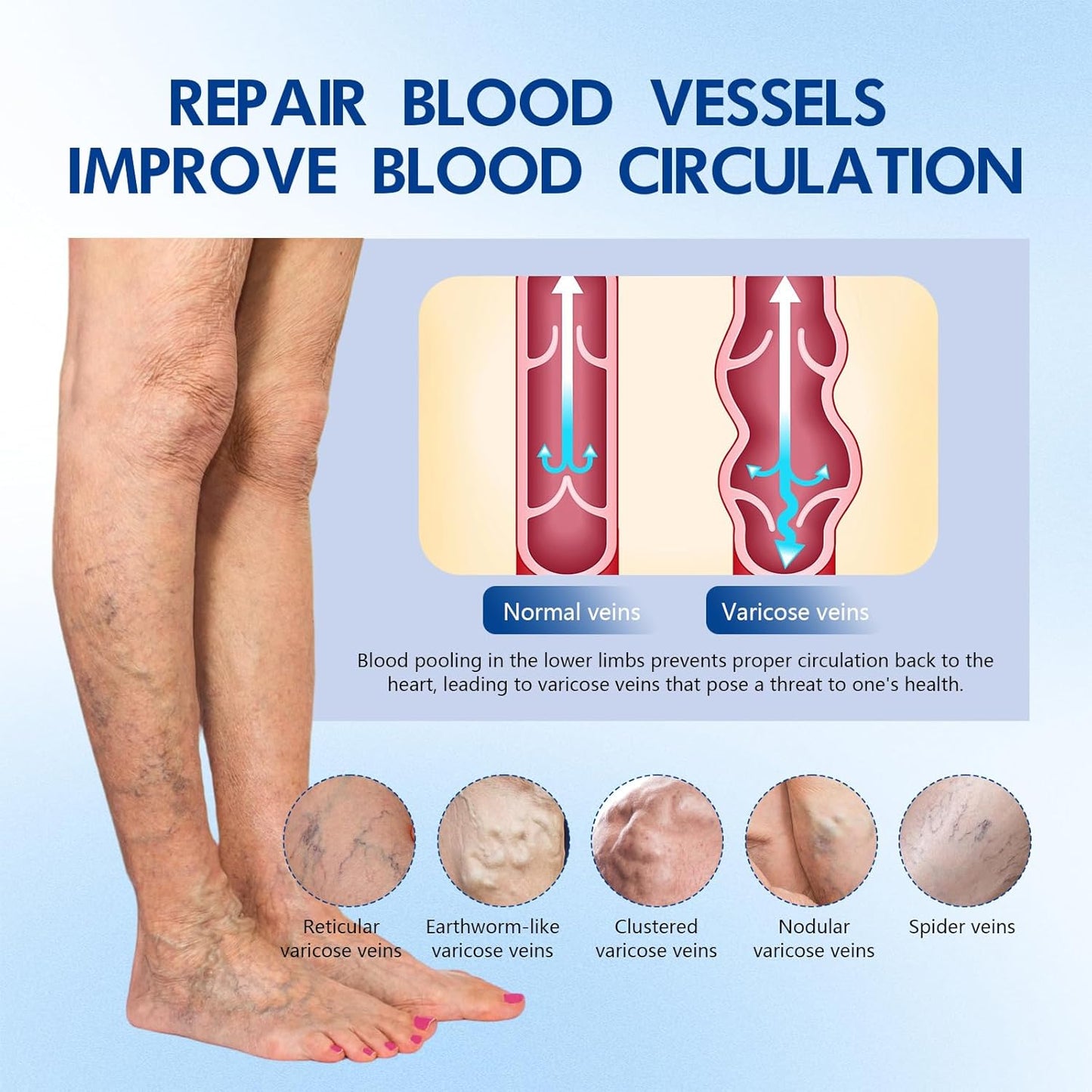 VeinTarget Microdarts Patch - Varicose Veins Treatment for Legs | All Skin Types (2 Boxes)
