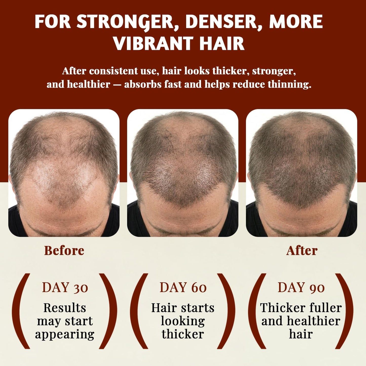 Batana Oil for Hair Growth – Natural & Pure Hair Oil, Prevents Hair Loss, Enhances Thickness, Restores Smoothness with Biotin, for Men & Women, Suitable for Curly & Straight Hair 4.23 oz
