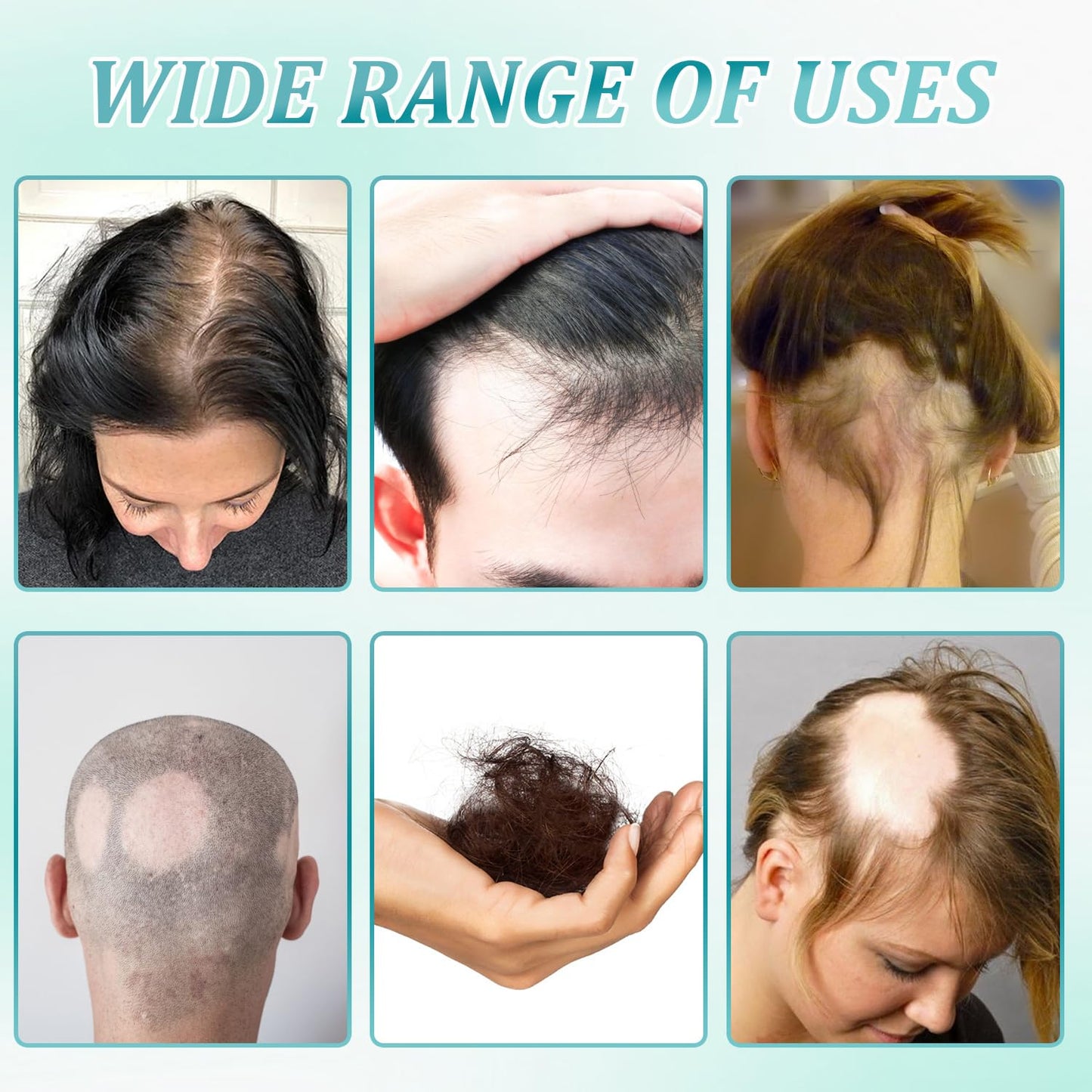 2pcs 5% Hair Growth Scalp Massage Cream, Professional Hair Care Cream, Anti Hair Loss with Rosemary Biotin for Men Women, Strengthens Hair Roots & Fast Regrowth