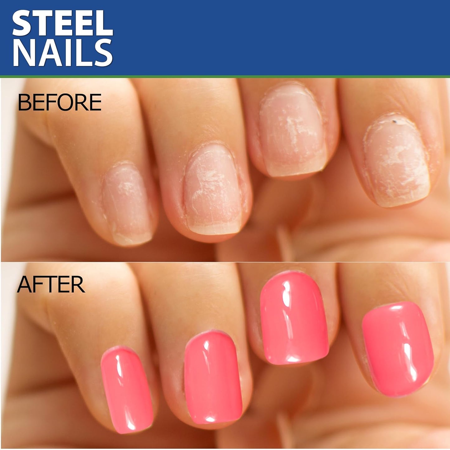 Steel Nails Hardener | Strengthen Nails with Keratin, Calcium & Garlic Extract