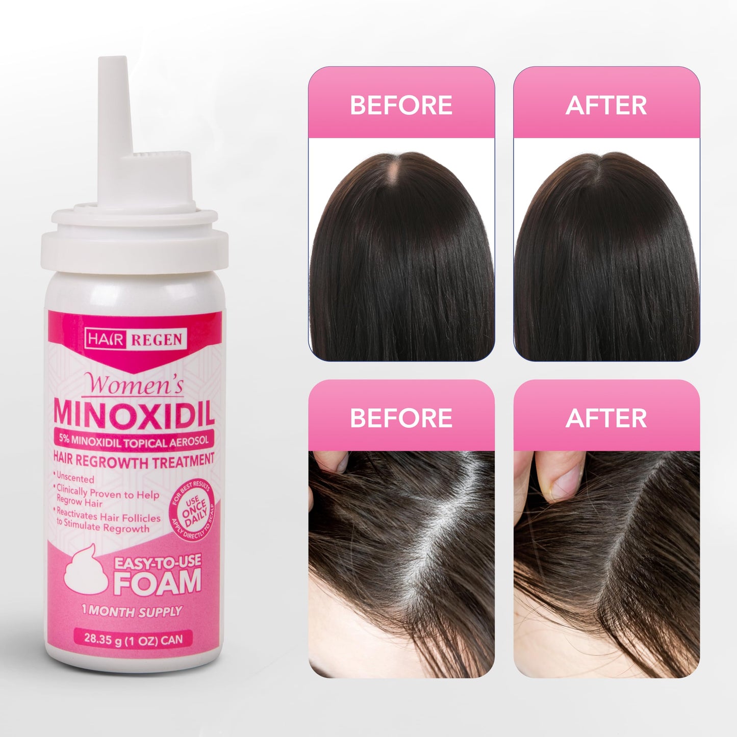 Hair Regen Minoxidil Foam for Women 5% Percent - Women's Hair Growth Treatment for Her - Topical Foaming Minoxidil for Women - Great for Hair Regrowth and Reduce Hair Loss - 1 Pack as 1 Month Supply