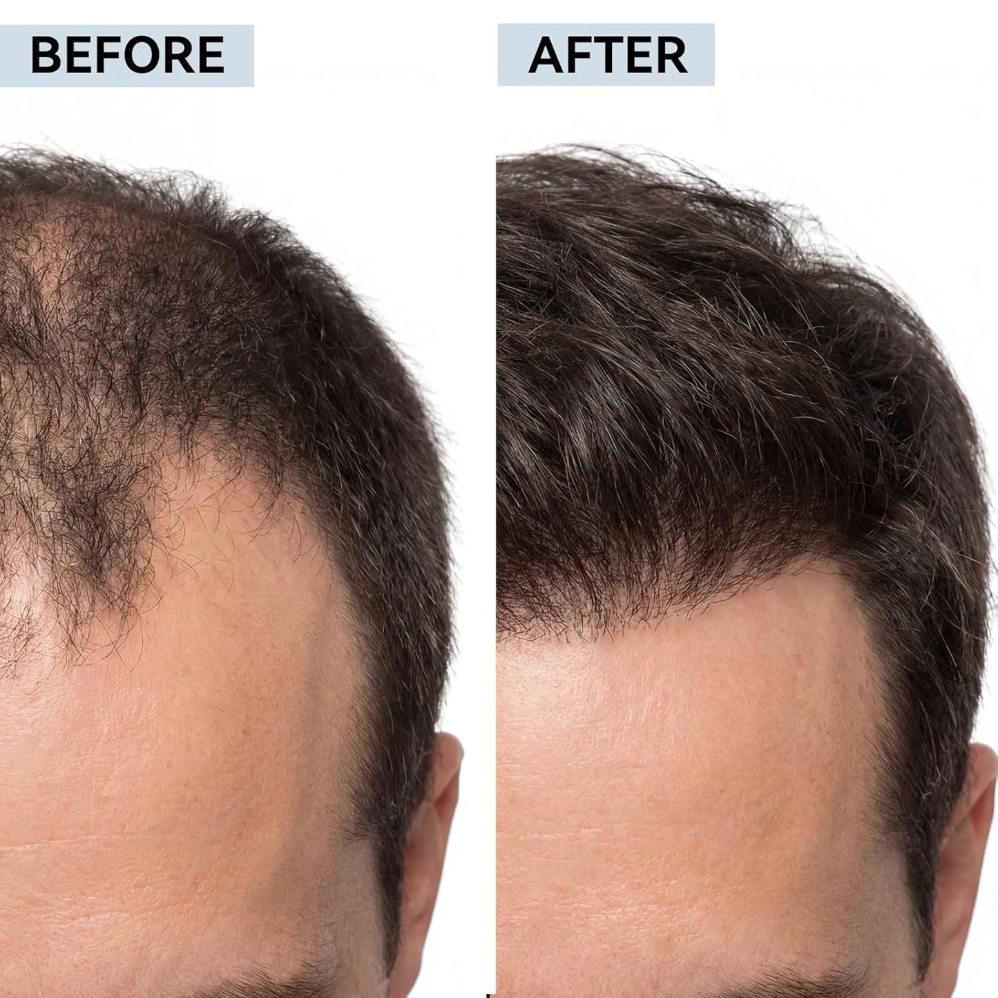 Hair Regrowth System - Multi-Peptide Serum with Copper Peptides & Ginseng for Thicker, Fuller Hair | Unisex