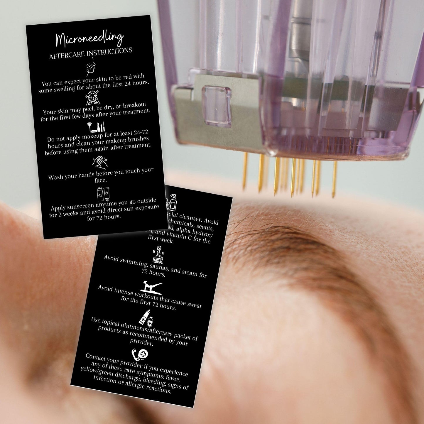 Boutique Marketing LLC Microneedling Aftercare Cards | 50 Pack | Size 2x3.5” inches Business Card Size | Microneedle Black with White Font and Icons Design