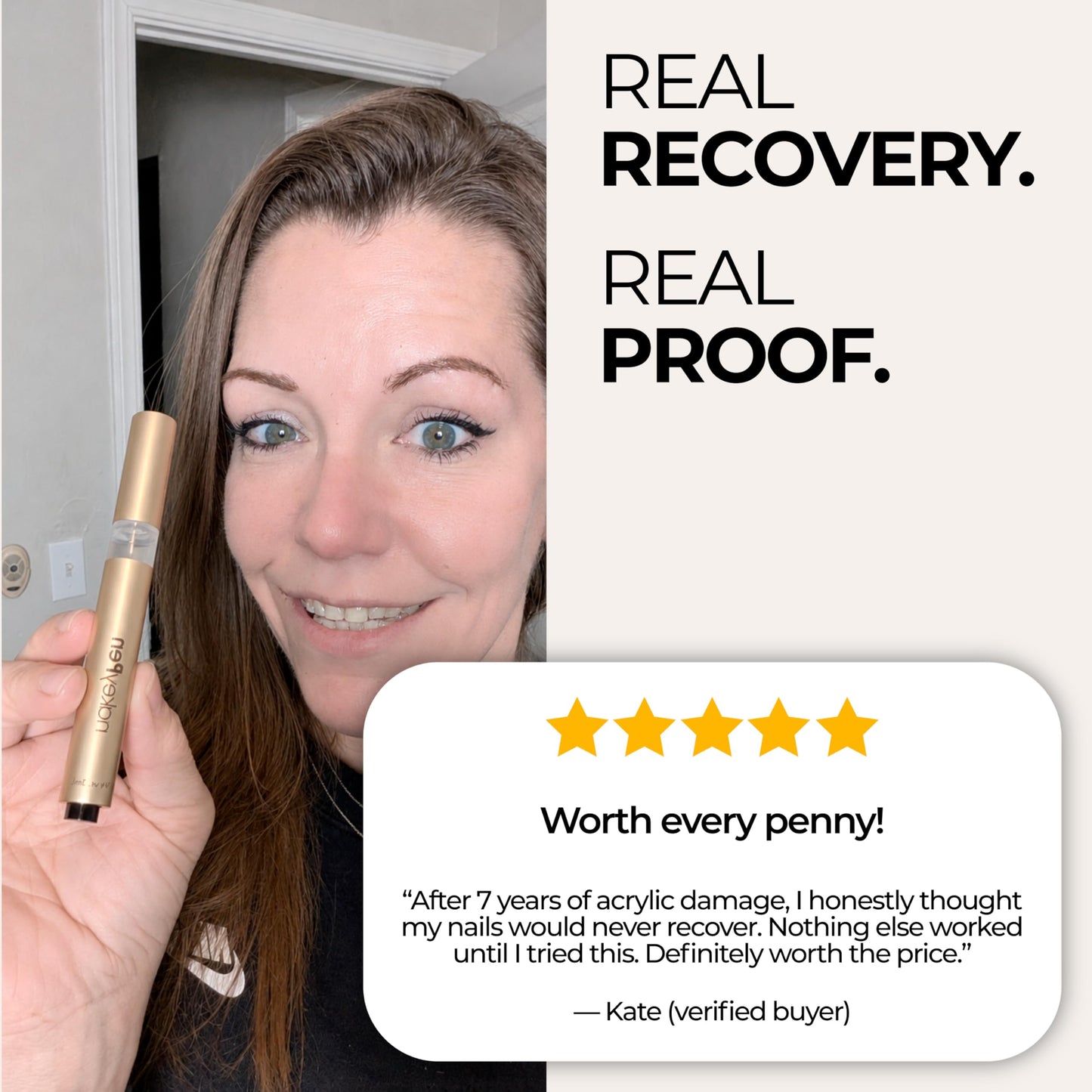 nakeyNails Complete Nail Recovery Treatment for Gel & Acrylic Damage from Within for Stronger, Healthier Nails | With Keratin, Peptides, Niacinamide & Hyaluronic Acid — 45-Day Supply