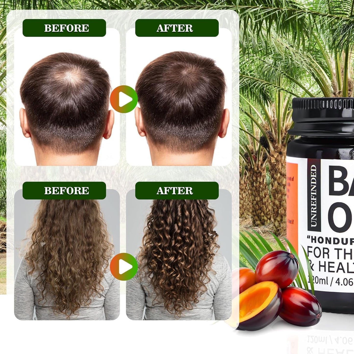 Organic Batana Oil for Hair Growth - 100% Pure Treatment for Thick, Strong Hair | 4 fl oz